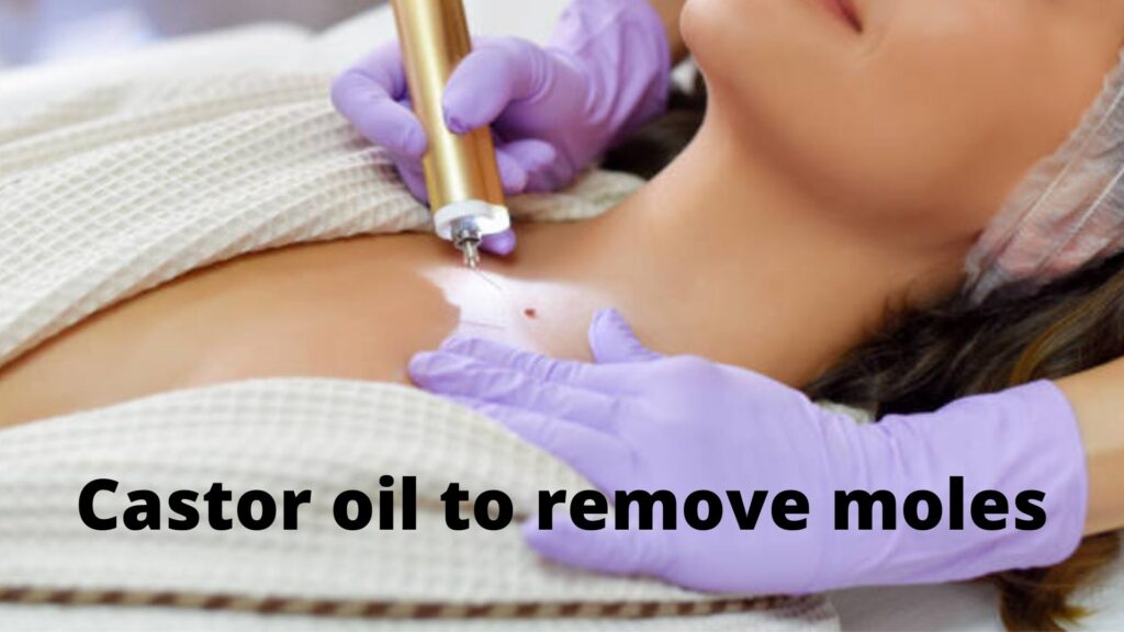 Castor oil to remove moles