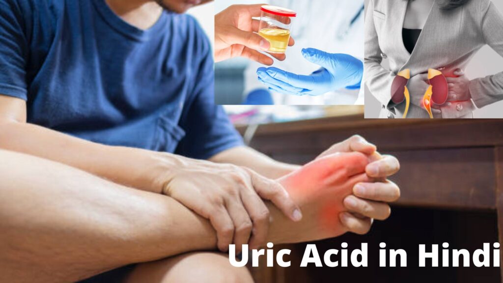 Uric Acid in Hindi