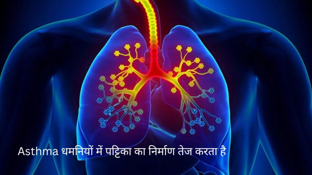 Asthma धमनियों में पट्टिका का निर्माण तेज करता है