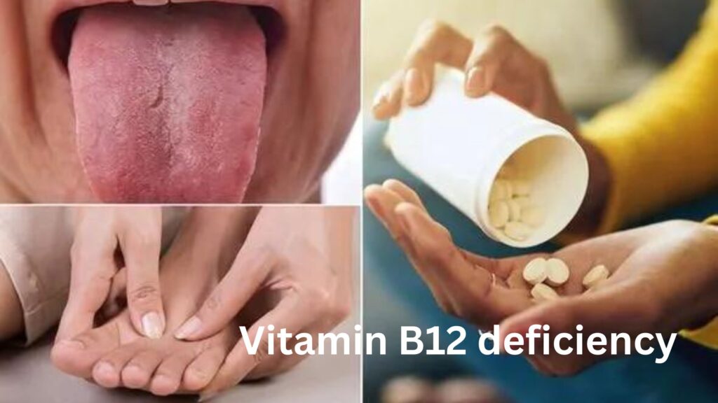 Vitamin B12 deficiency in Hindi