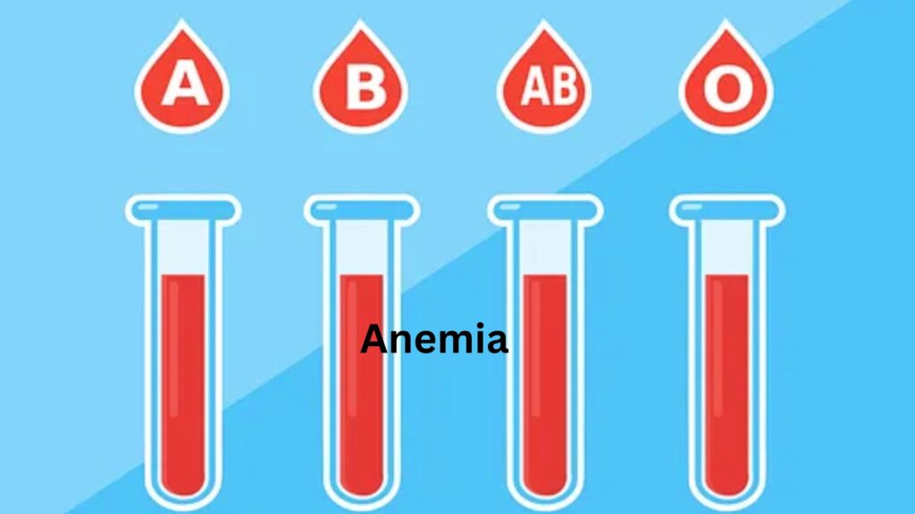 Anemia 