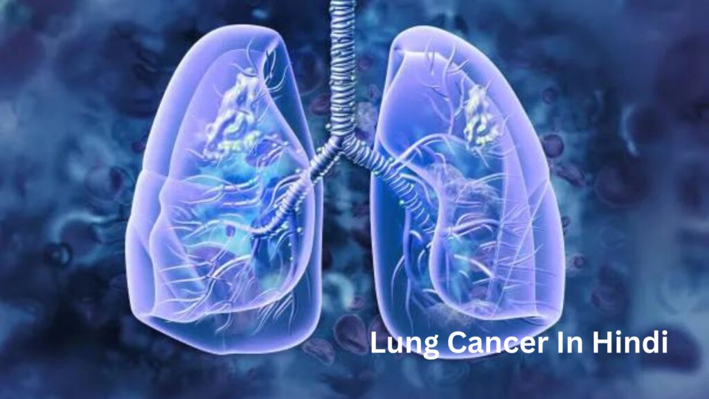 Lung Cancer In Hindi