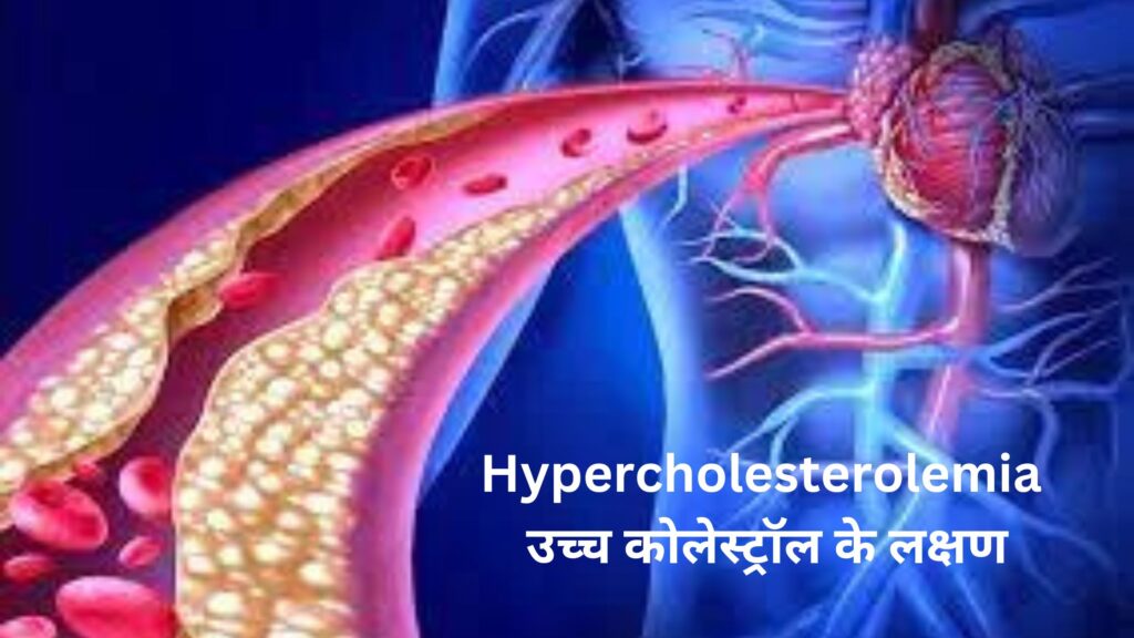 Hypercholesterolemia उच्च कोलेस्ट्रॉल के लक्षण