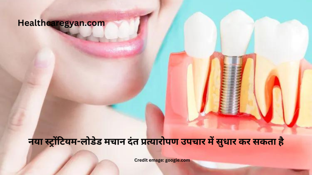 Dental implant