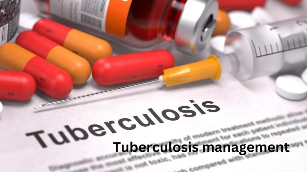 Tuberculosis management