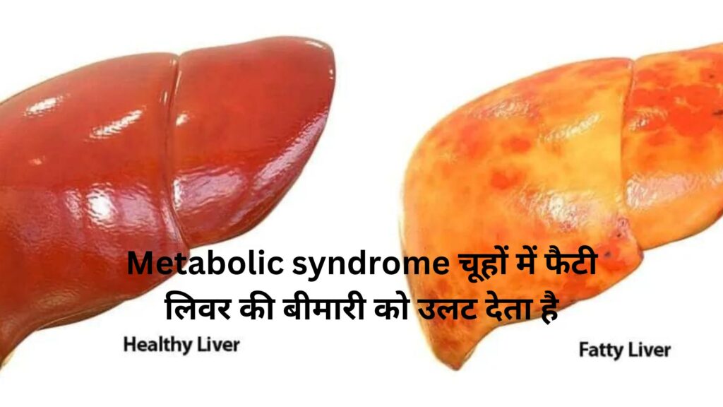 Metabolic syndrome चूहों में फैटी लिवर की बीमारी को उलट देता है