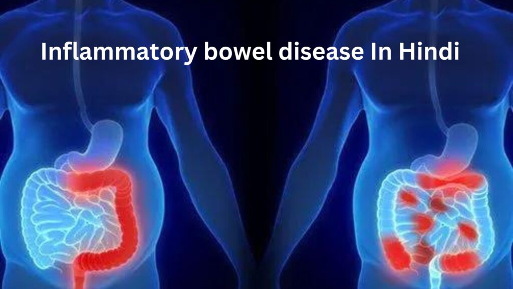 Inflammatory bowel disease In Hindi