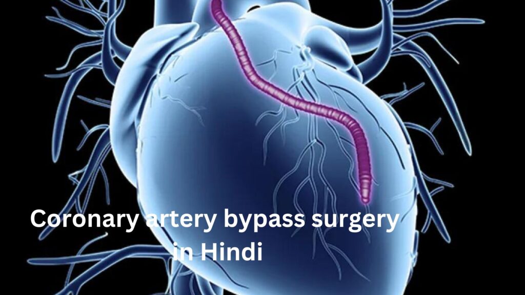 Coronary artery bypass surgery in Hindi