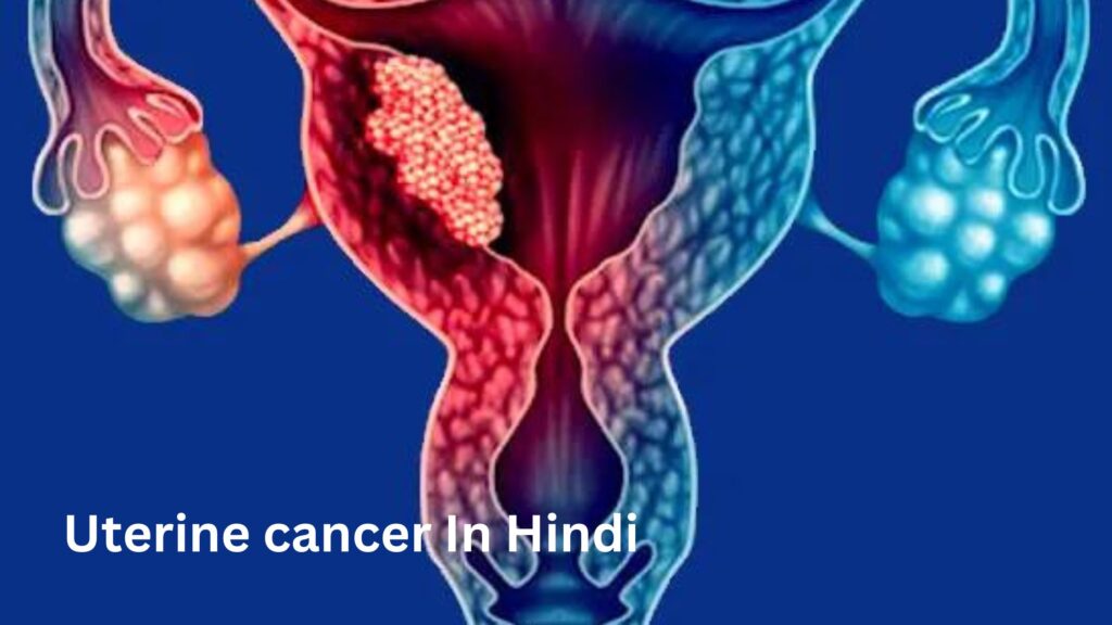 Uterine cancer In Hindi