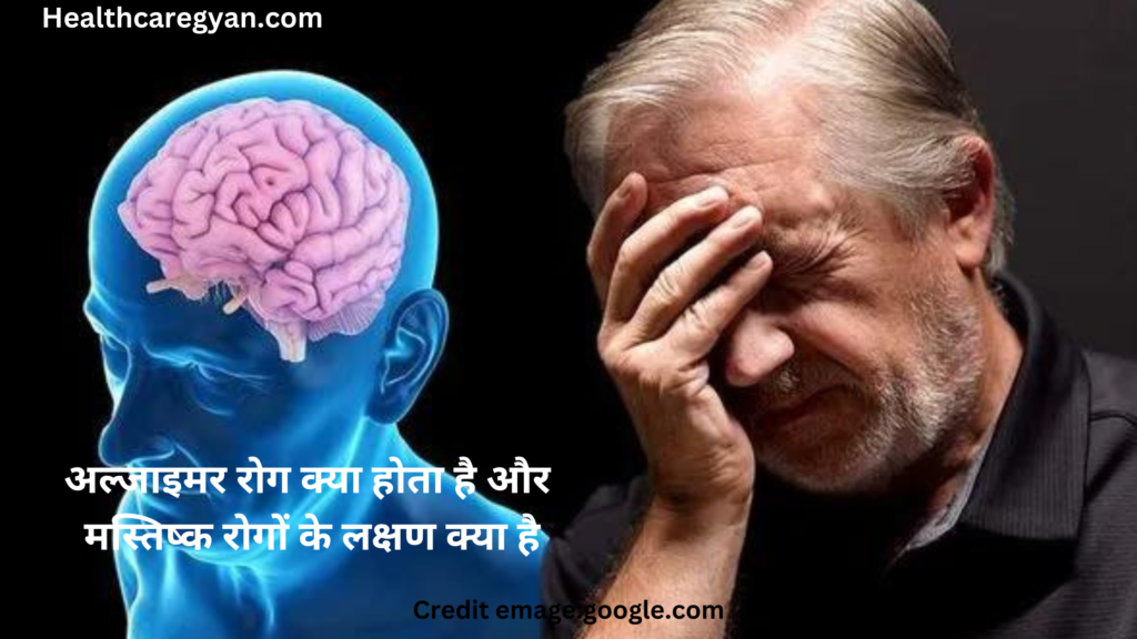 Alzheimer's disease In Hindi