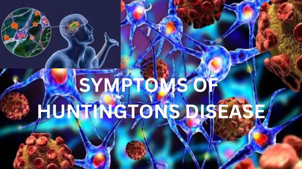 Signs And Symptoms Of Huntington’s Disease In 2024