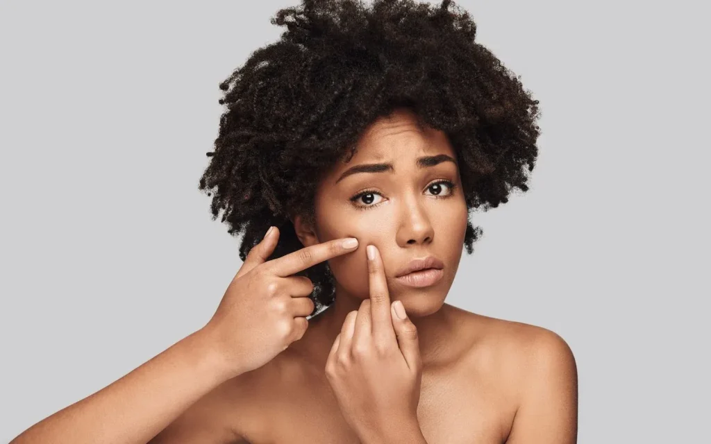 Expert Advice: Dermatologist Tips for Banishing Dark Spots Effectively