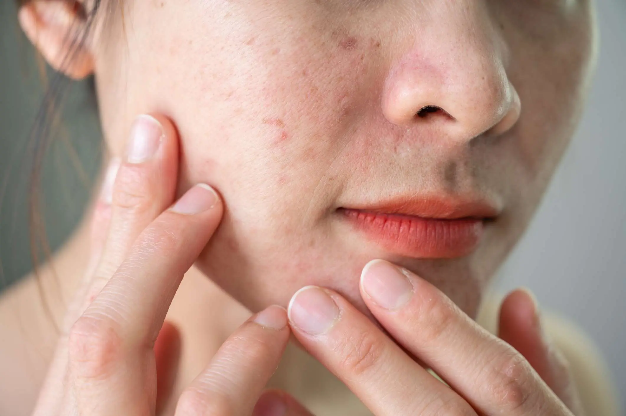 11 Ways to Unclog Your Pores For Good, According to Dermatologists